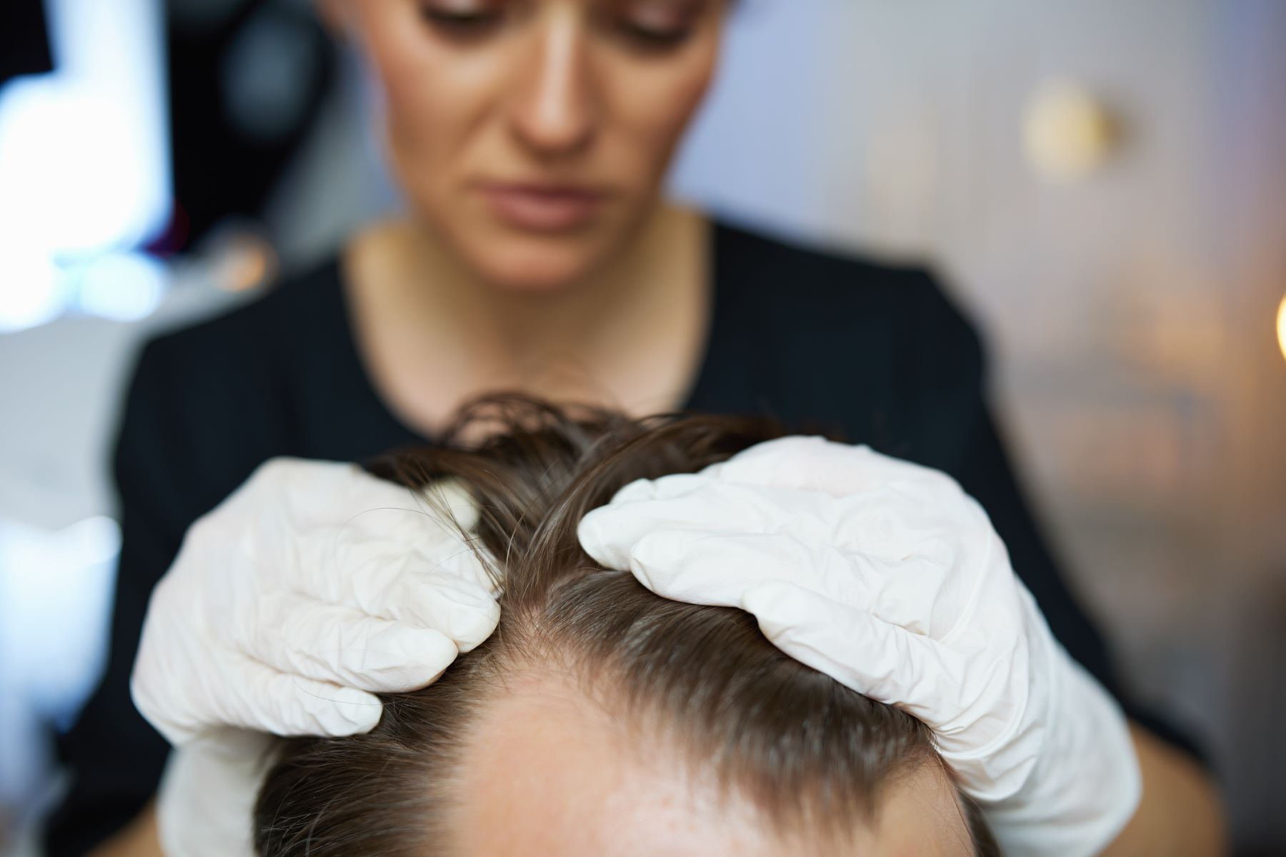 Hair loss patient with a hair doctor