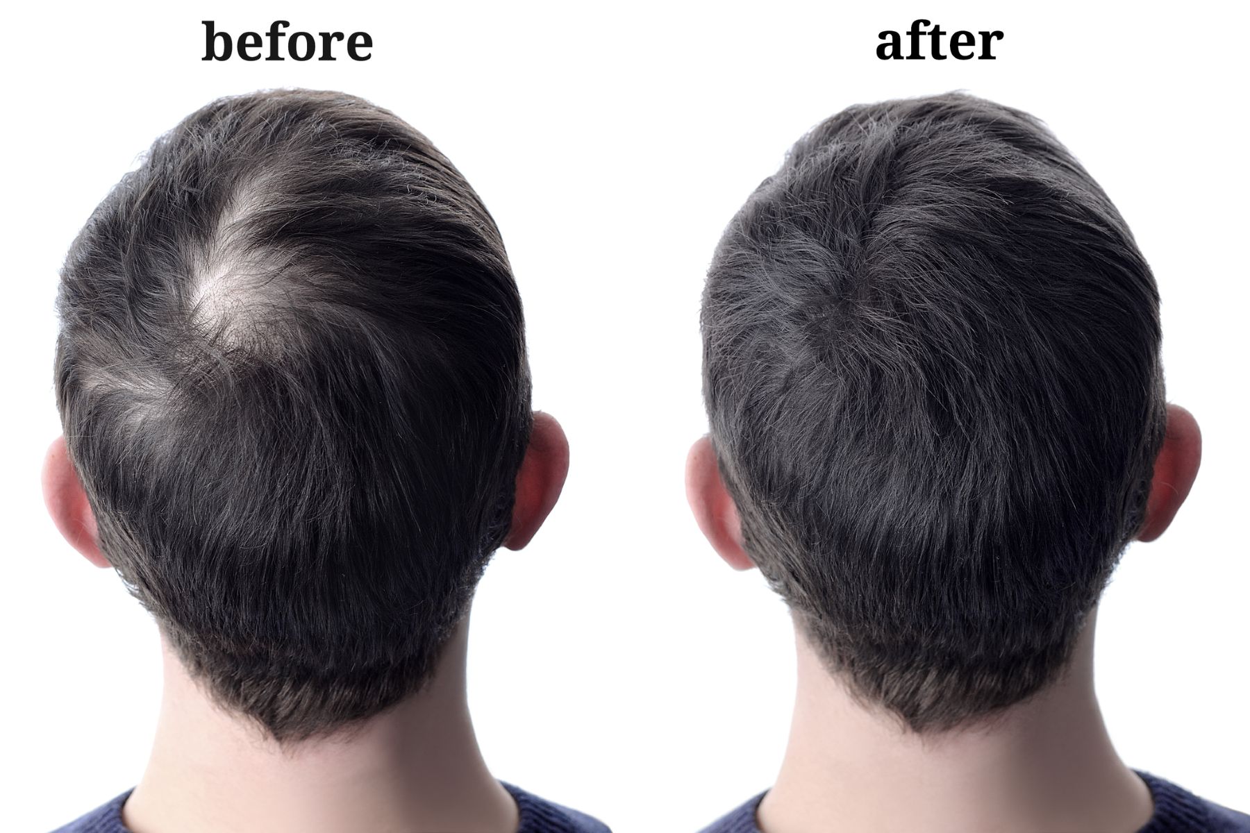 Hair products that can help mask your crown thinning