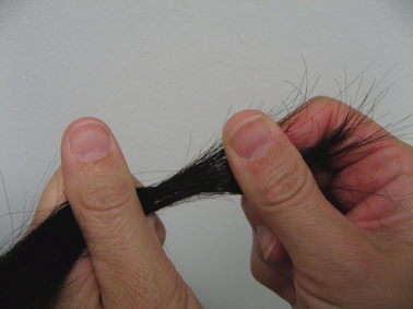 Hair tug test for hair loss