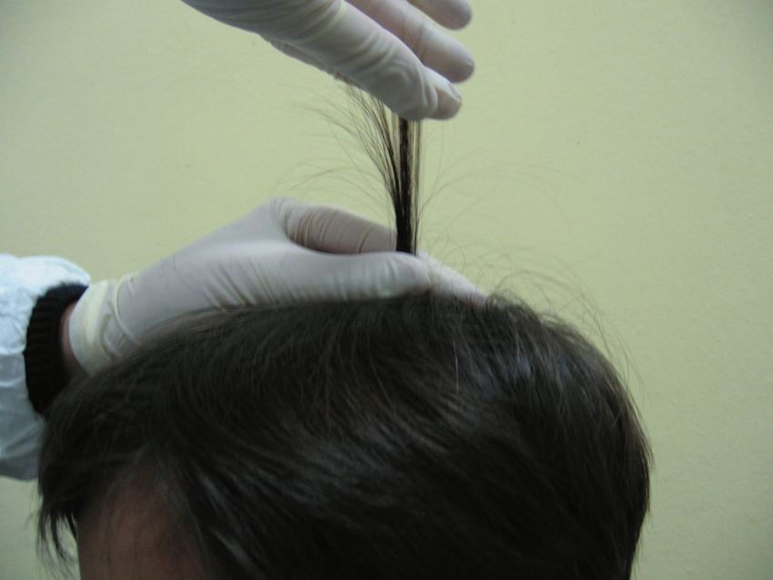 How the hair pull test is performed