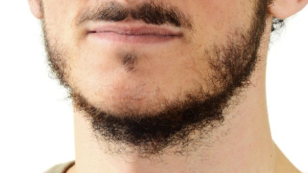 Incipient, yet-to-mature beard growth on a teenager