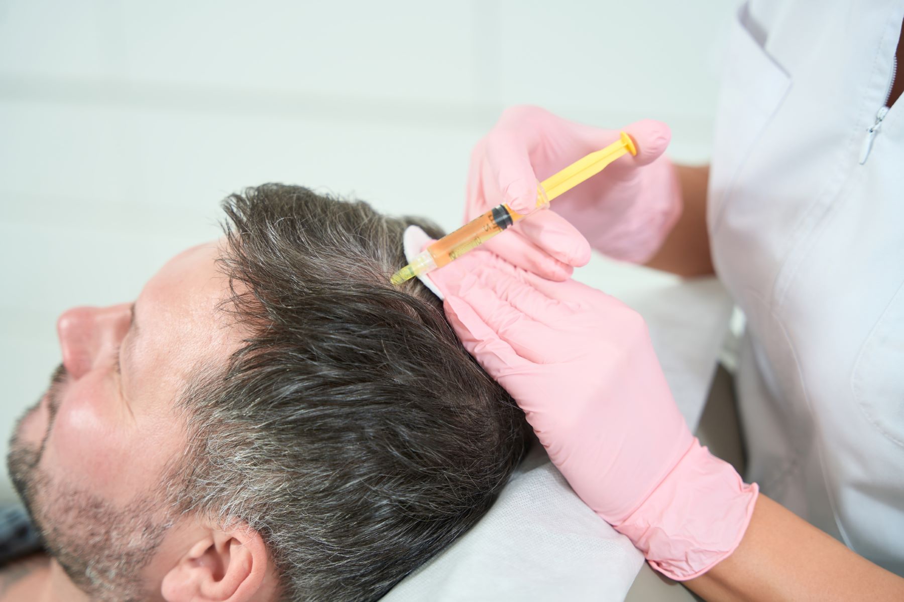 Male patient getting PRP hair treatment