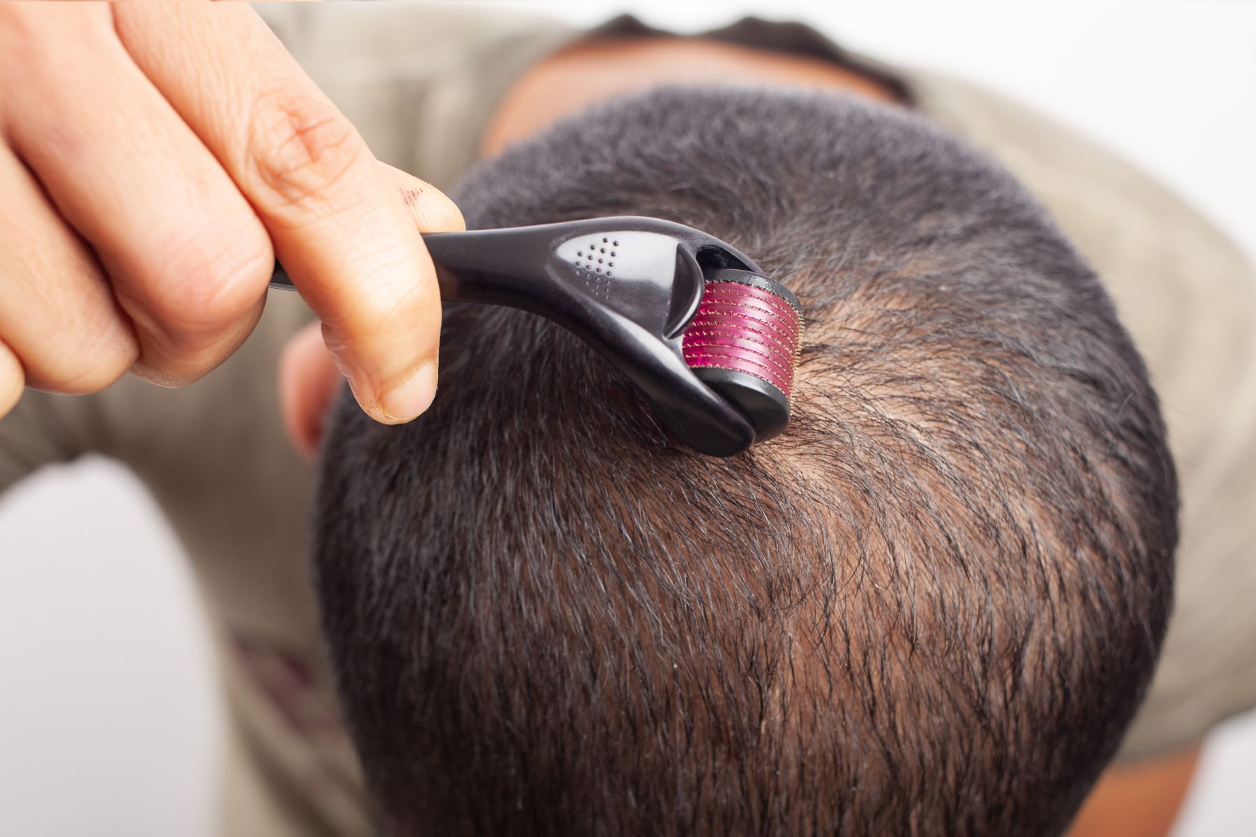 Man using derma roller on scalp