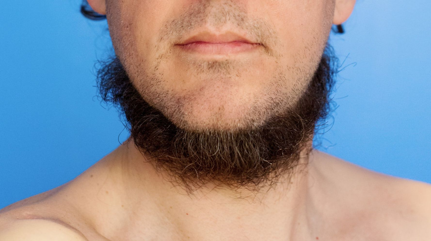 Man with a neck beard