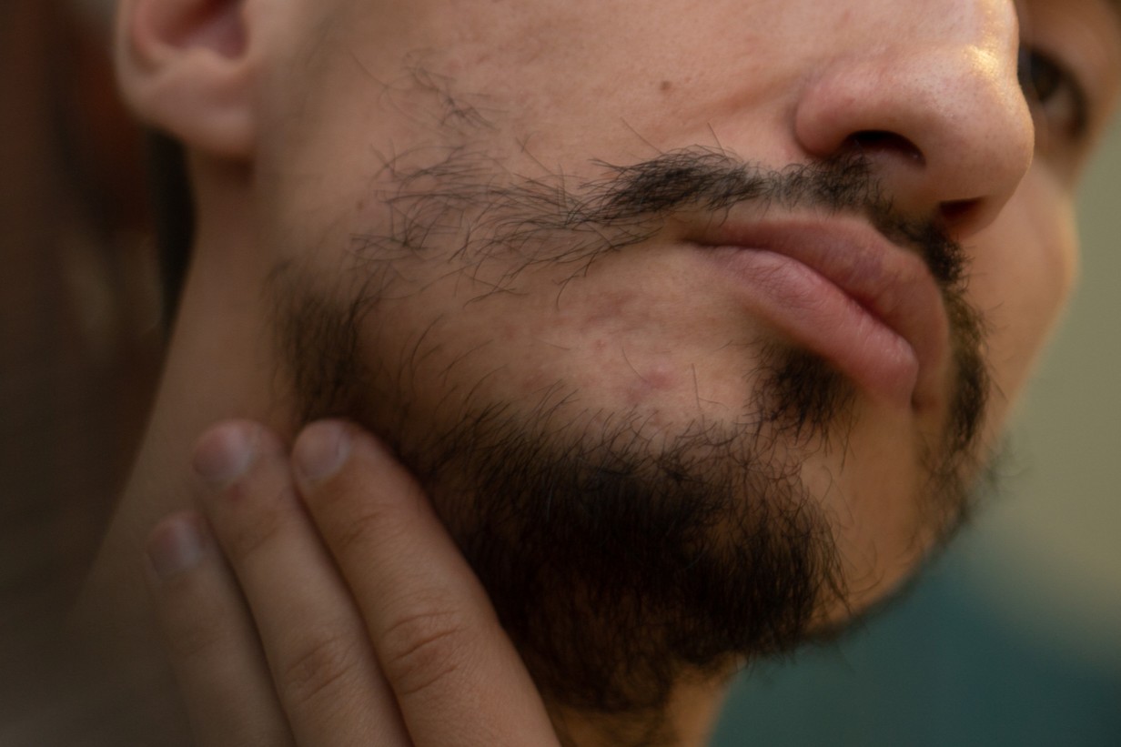 Man with a sparse, patchy beard