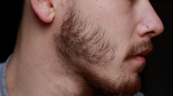 Man with a sparse, patchy beard