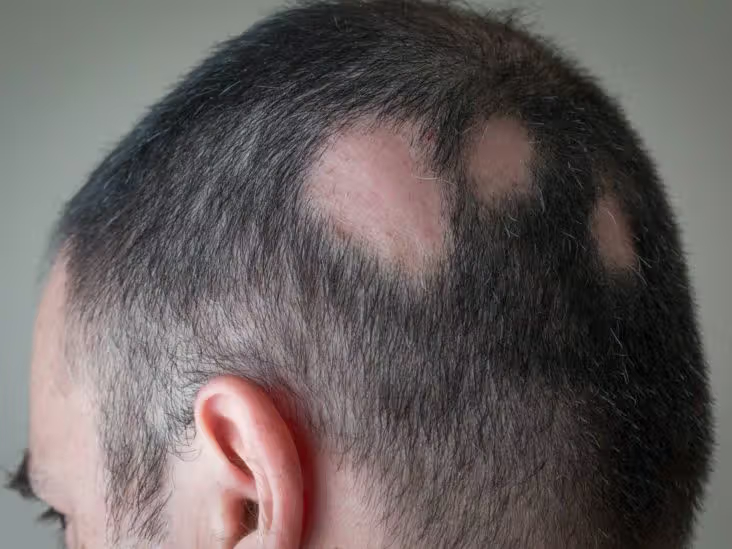 Balding Guys and the Man Bun: A Practical Guide - Man Bun Hairstyle