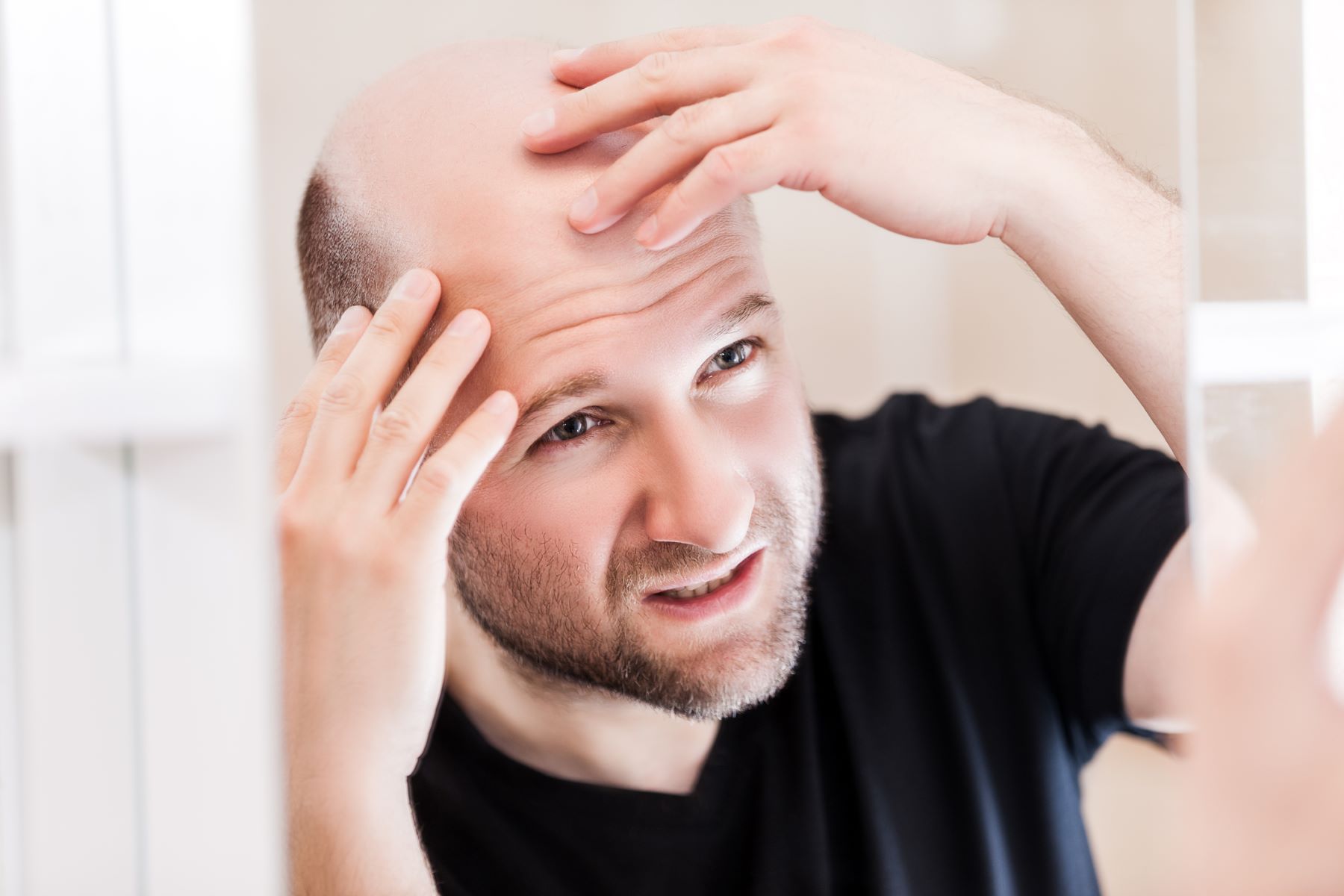 Man wondering about the bald spot on his crown