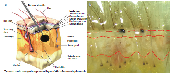 Scalp micropigmentation dot positioning in skin cross-section (diagram next to histology slide)