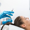 What Is The Success Rate Of PRP Hair Treatment?