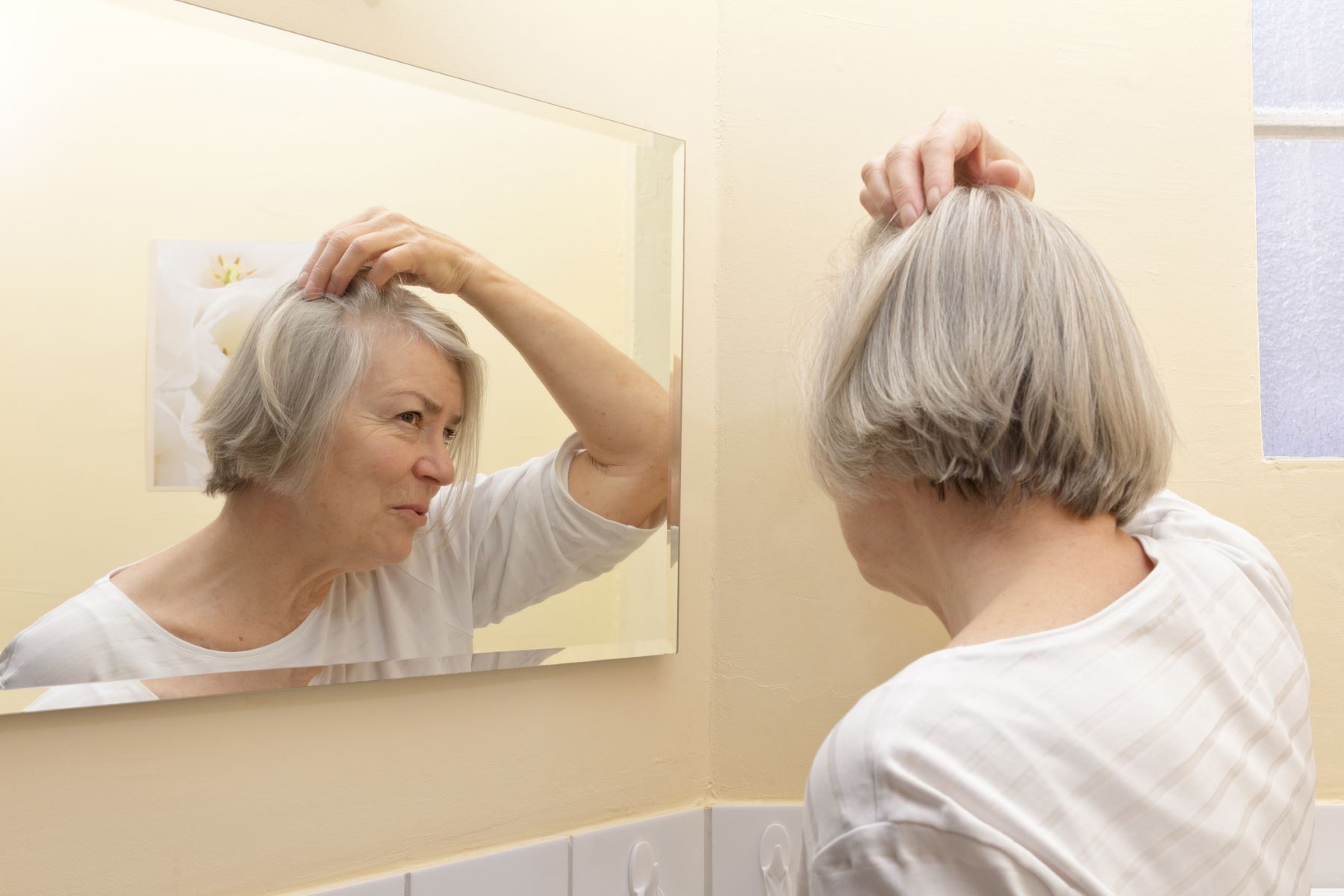 Woman wondering if her thyroid hair loss will grow back