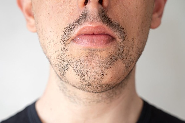 Patchy Beard