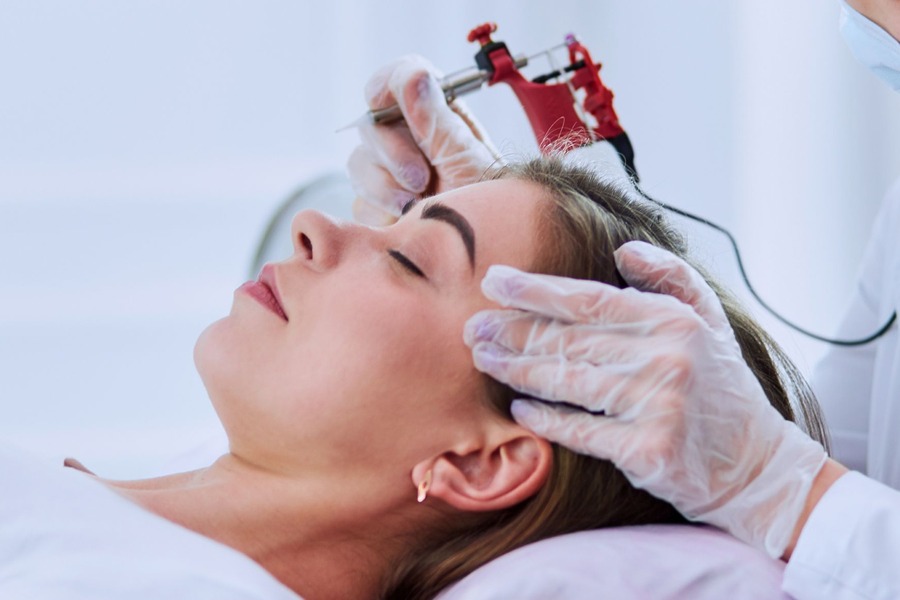 Scalp Micropigmentation Women