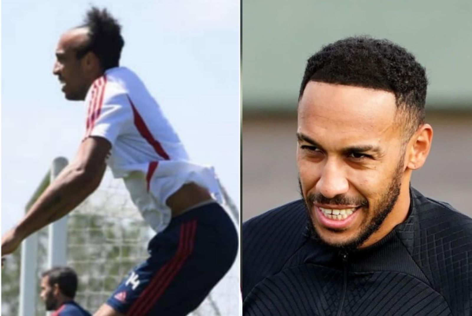 Aubameyang before and after his rumoured hair transplant