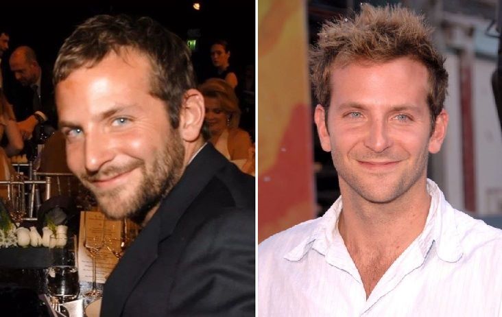 Bradley Cooper showing signs of hair loss