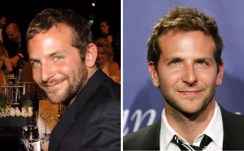 Bradley Cooper showing signs of hair loss