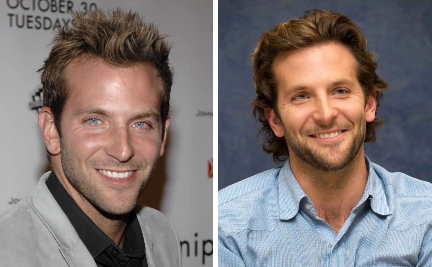 Bradley Cooper’s hairline changed between 2007 and 2008