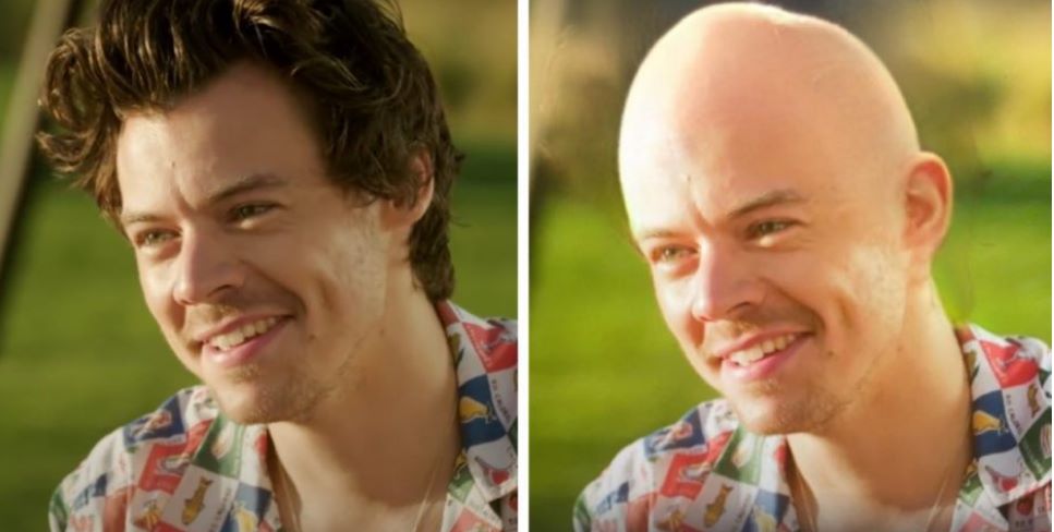 Fan-doctored image of Harry Styles going bald