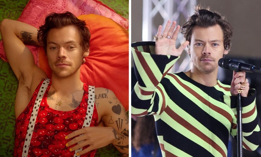 Is Harry Styles Balding? The Scoop on Harry’s Hair Journey