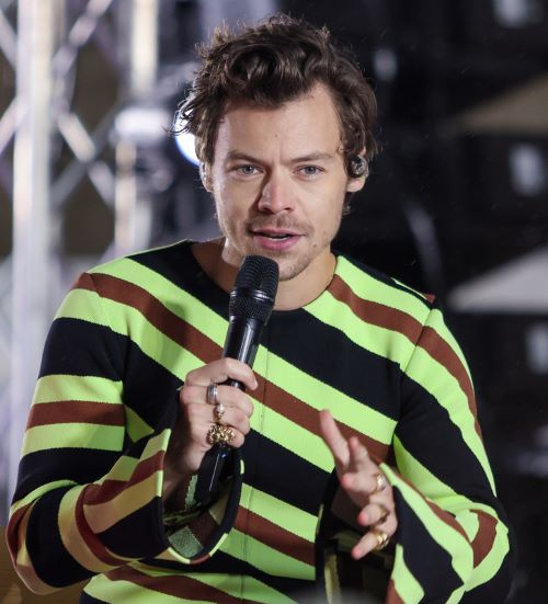 Harry Styles with light temple hair loss