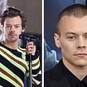 Is Harry Styles Balding? The Scoop On Harry’s Hair Journey