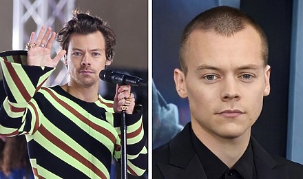 Is Harry Styles Balding? The Scoop On Harry’s Hair Journey