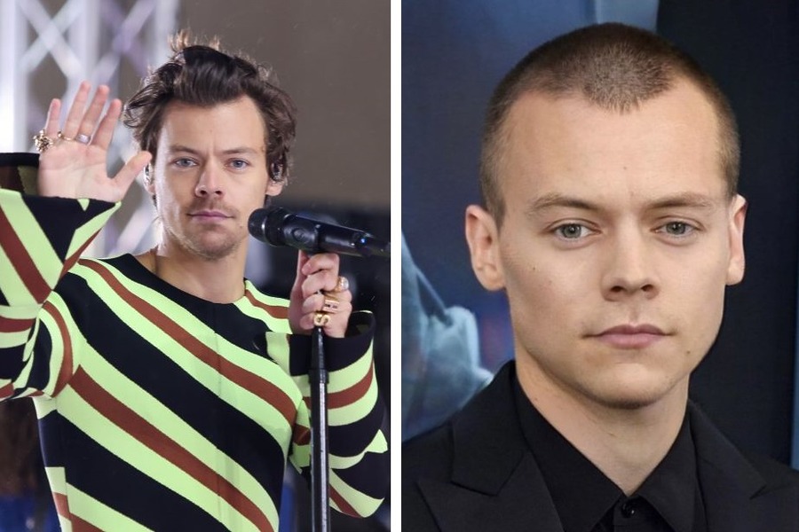 Is Harry Styles Balding? The Scoop On Harry’s Hair Journey