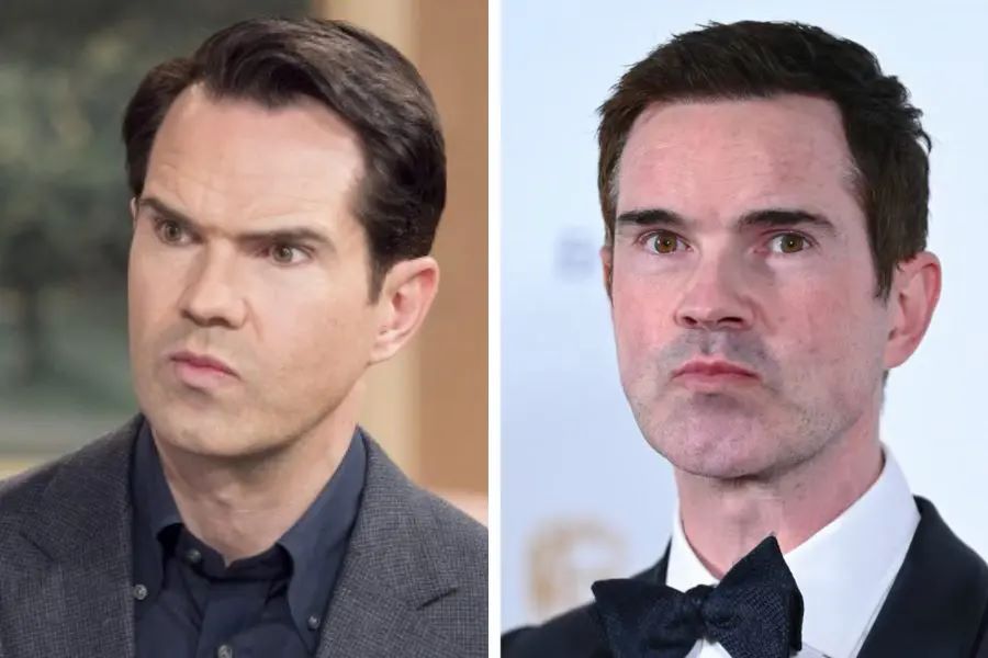 Jimmy Carr before and after his hair transplant