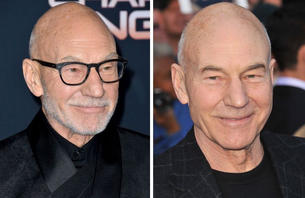 (L) Patrick Stewart bald with beard ; (R) Patrick Stewart bald without a beard