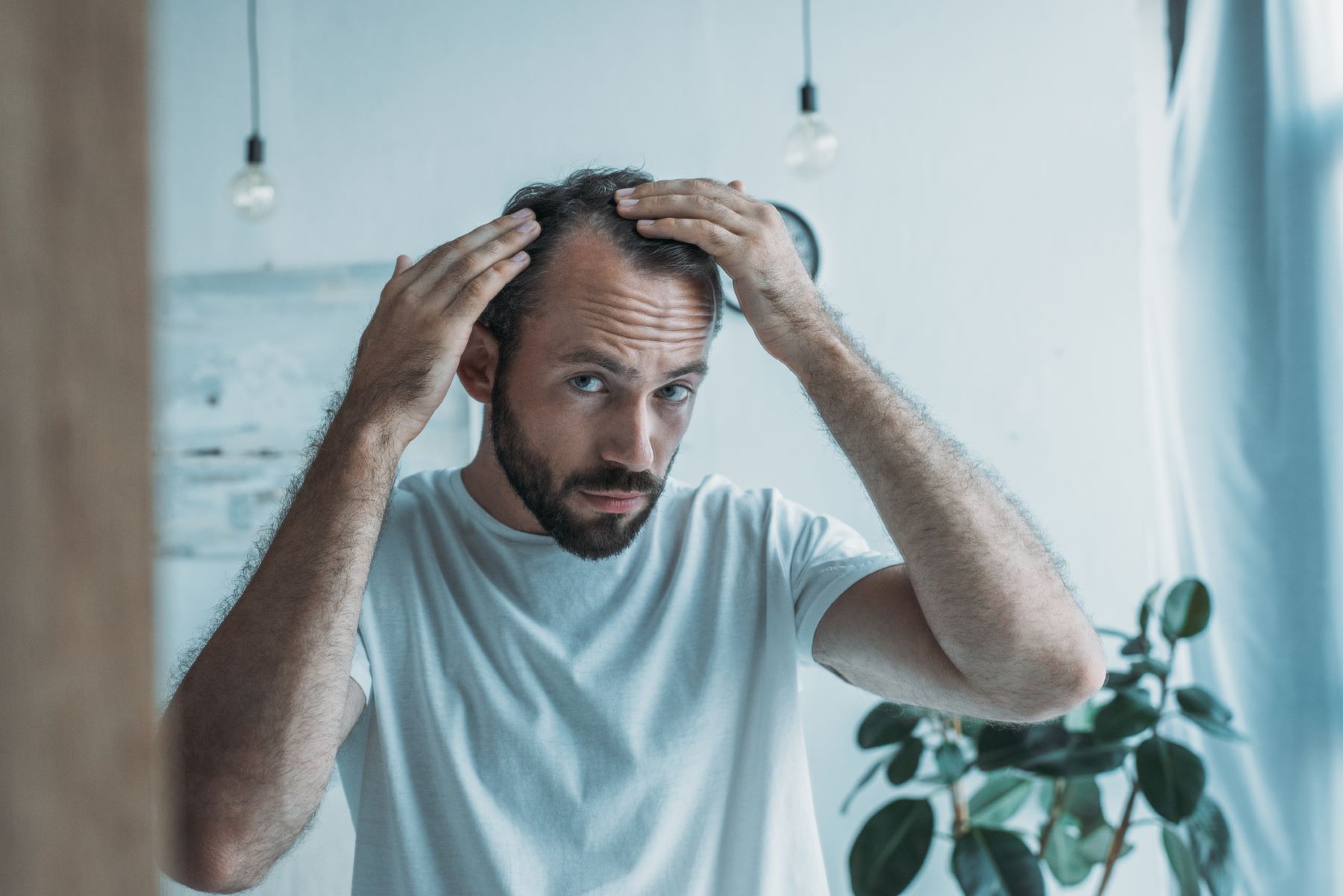 Man concerned about hair loss