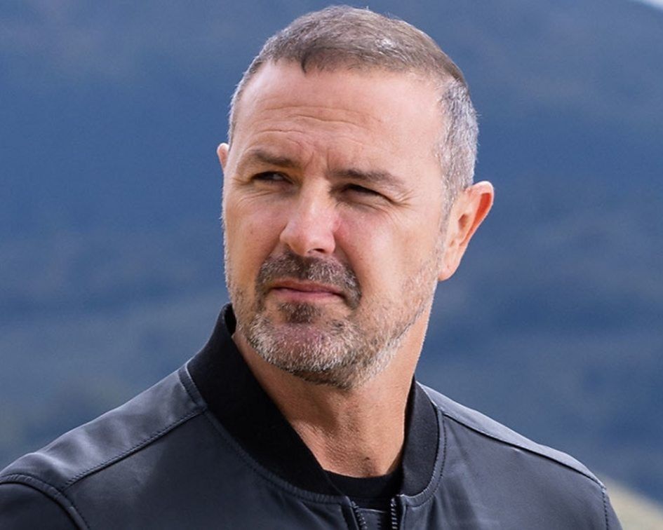 Paddy McGuinness contemplating getting a hair transplant