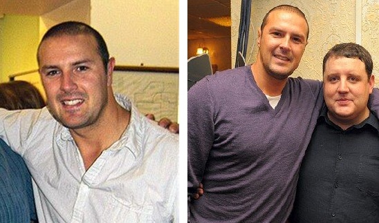 Paddy McGuinness’s first signs of balding