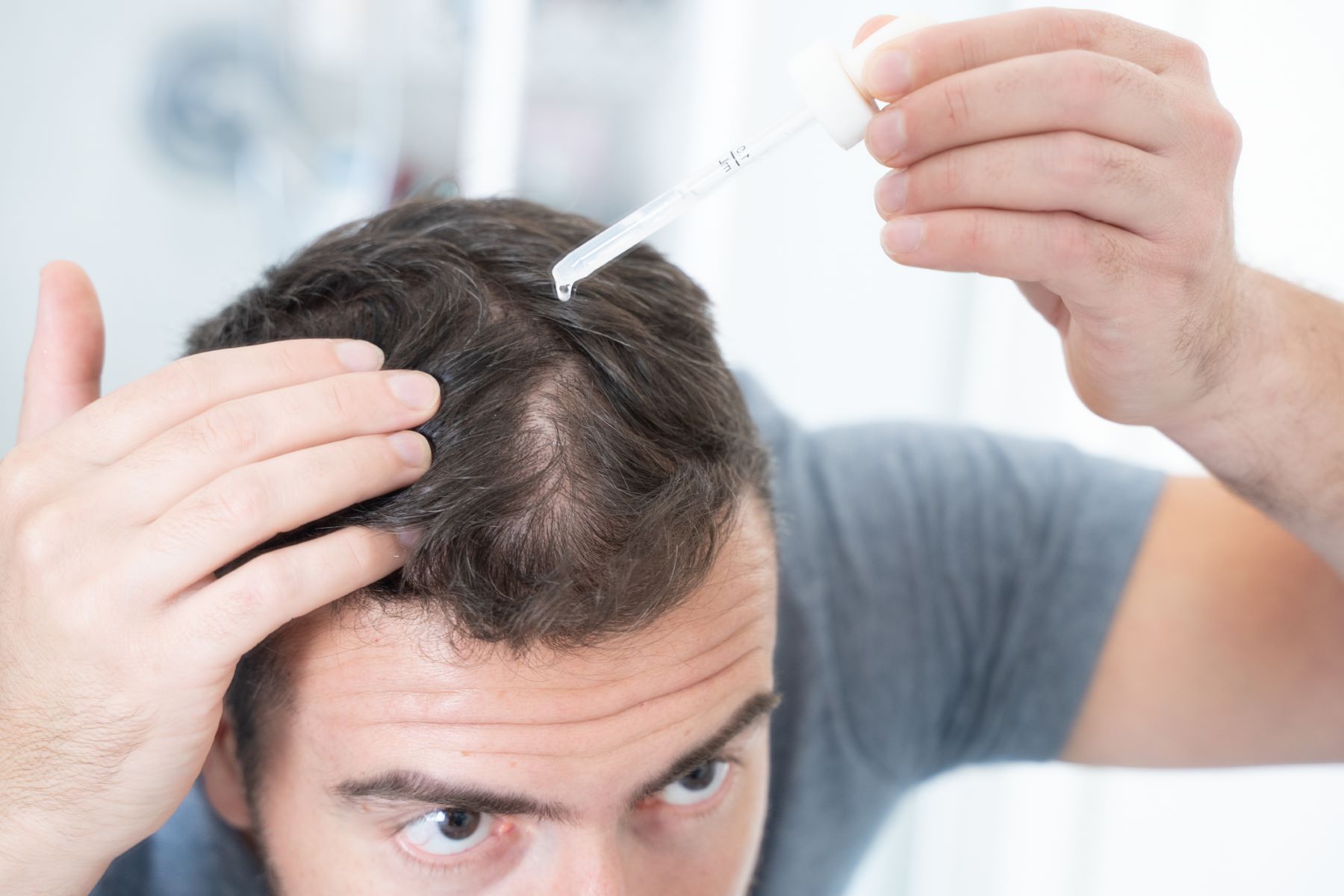 men using hair loss medication