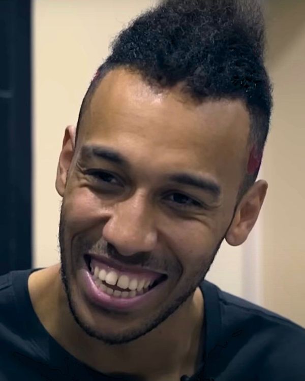 Auba’s hair visibly thinning in 2017