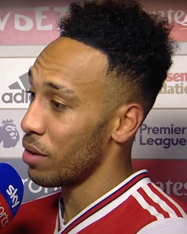 Aubameyang 2020 with painted hairline