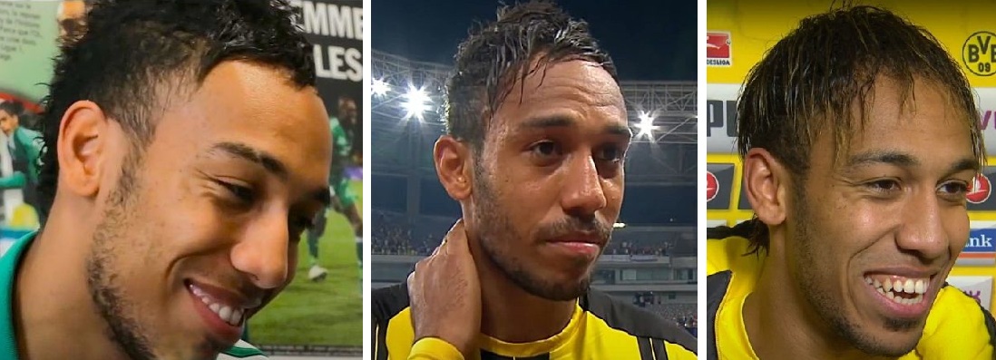Aubameyang&#8217;s Hair Transplant: Was it Surgery or Spray-on?, Wimpole Clinic