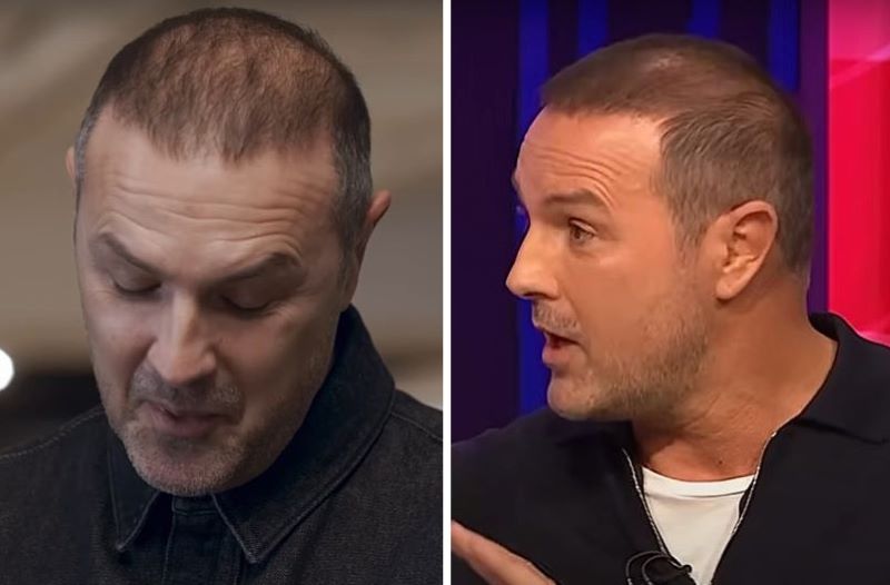 Paddy McGuinness' thinning hair in 2024