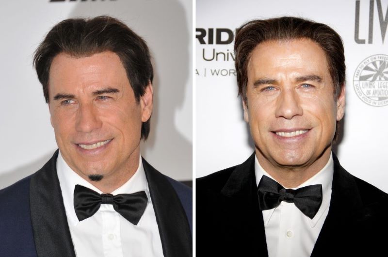 Travolta with different hairlines, likely toupees