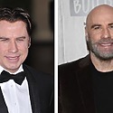 John Travolta’s Hair Transplant: Toupee Or Not Toupee?