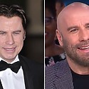 John Travolta’s Hair Transplant: Toupee Or Not Toupee?