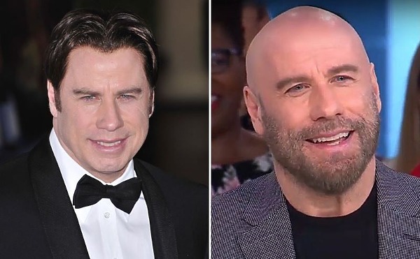 John Travolta’s Hair Transplant: Toupee or not Toupee?