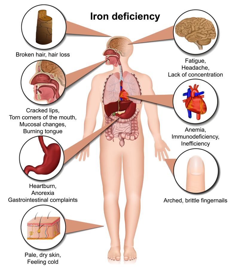 Symptoms of anaemia