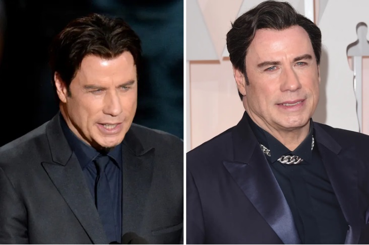 Travolta with different hairlines, likely toupees