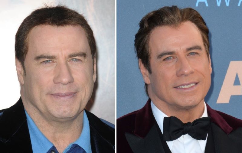 Travolta’s wig-wearing years