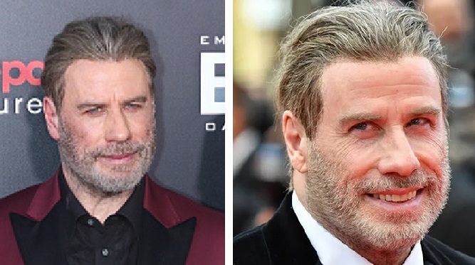 Travolta’s wig-wearing years