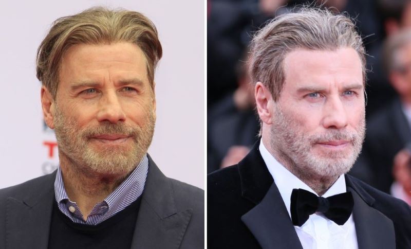 Travolta’s wig-wearing years