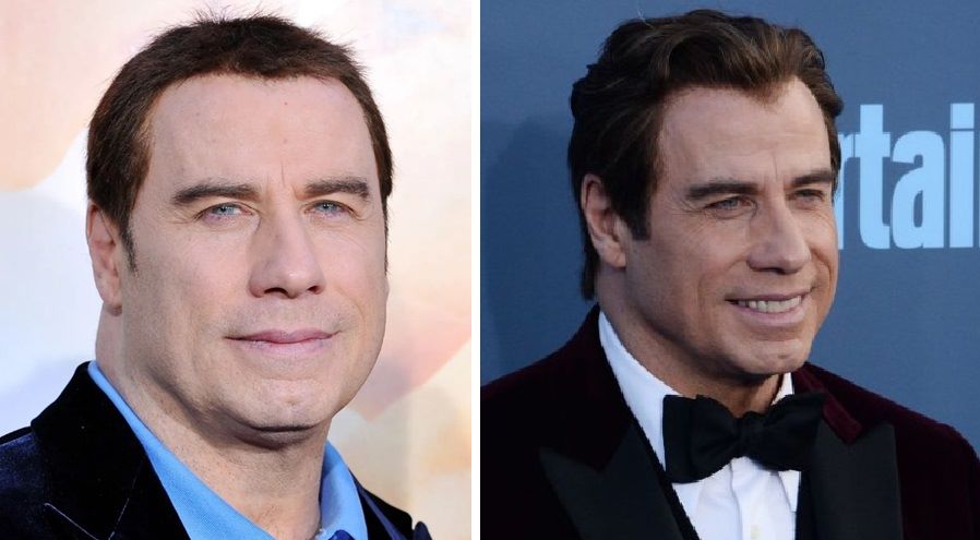 Travolta’s wig-wearing years