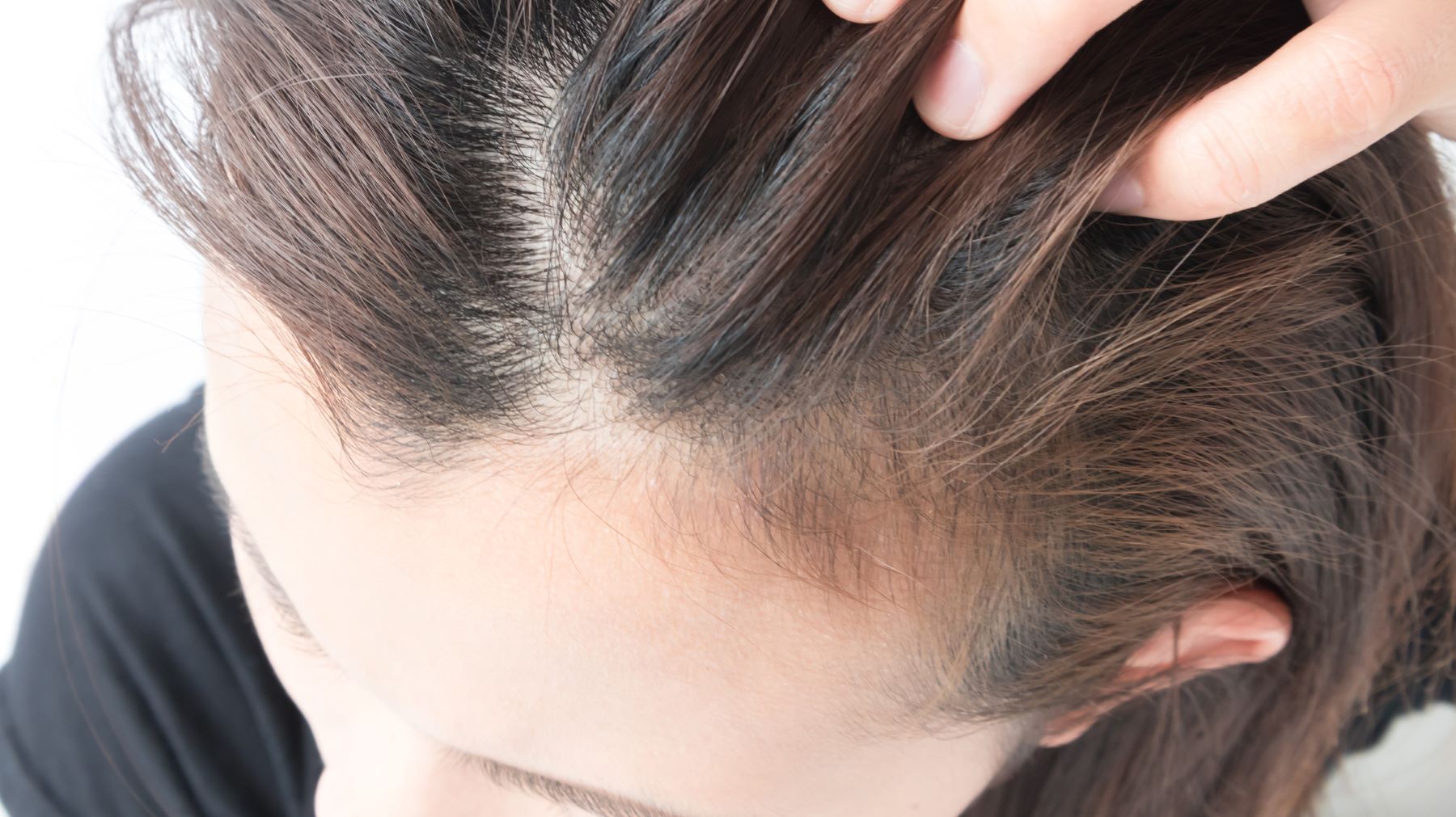 woman with greying and thinning hair