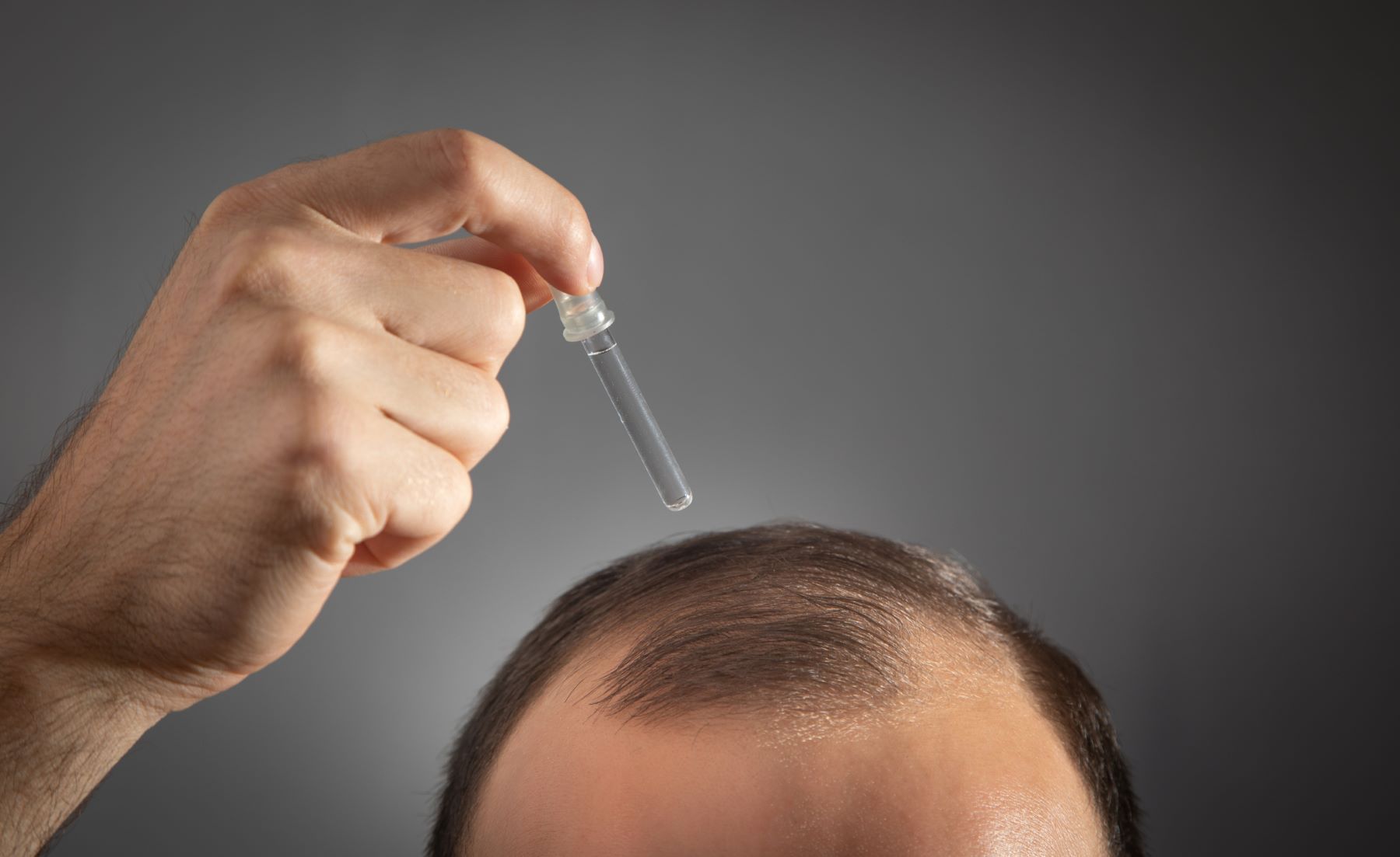 Man applying Minoxidil