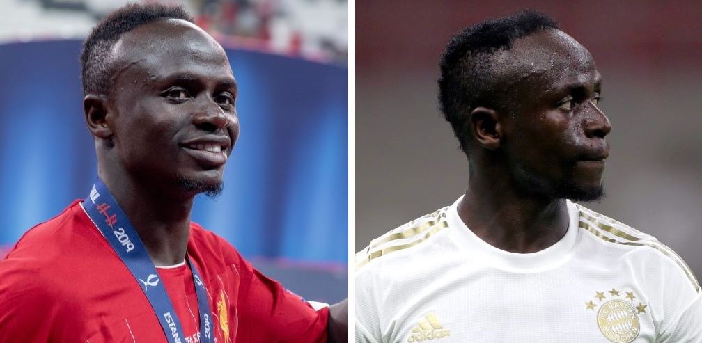 Sadio Mane before and after hair transplant